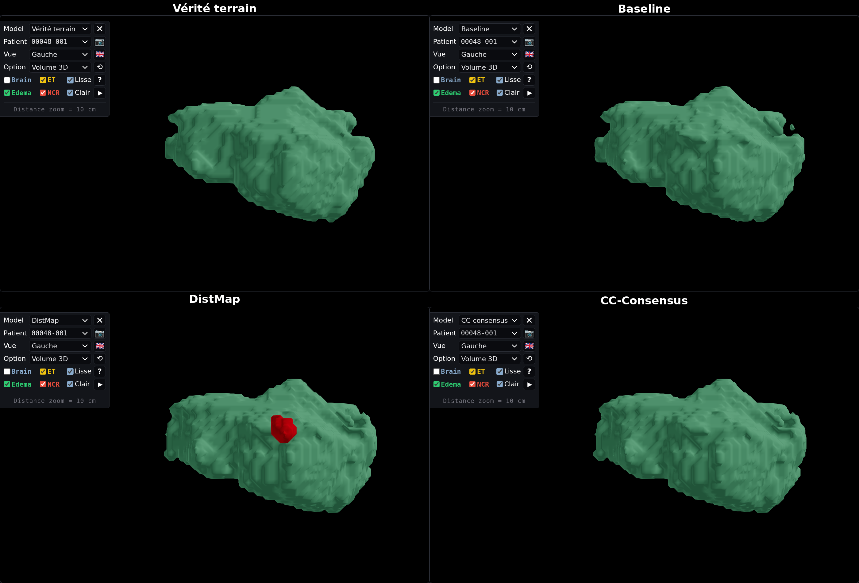 Figure 1 — Cas C1 (00048-001)