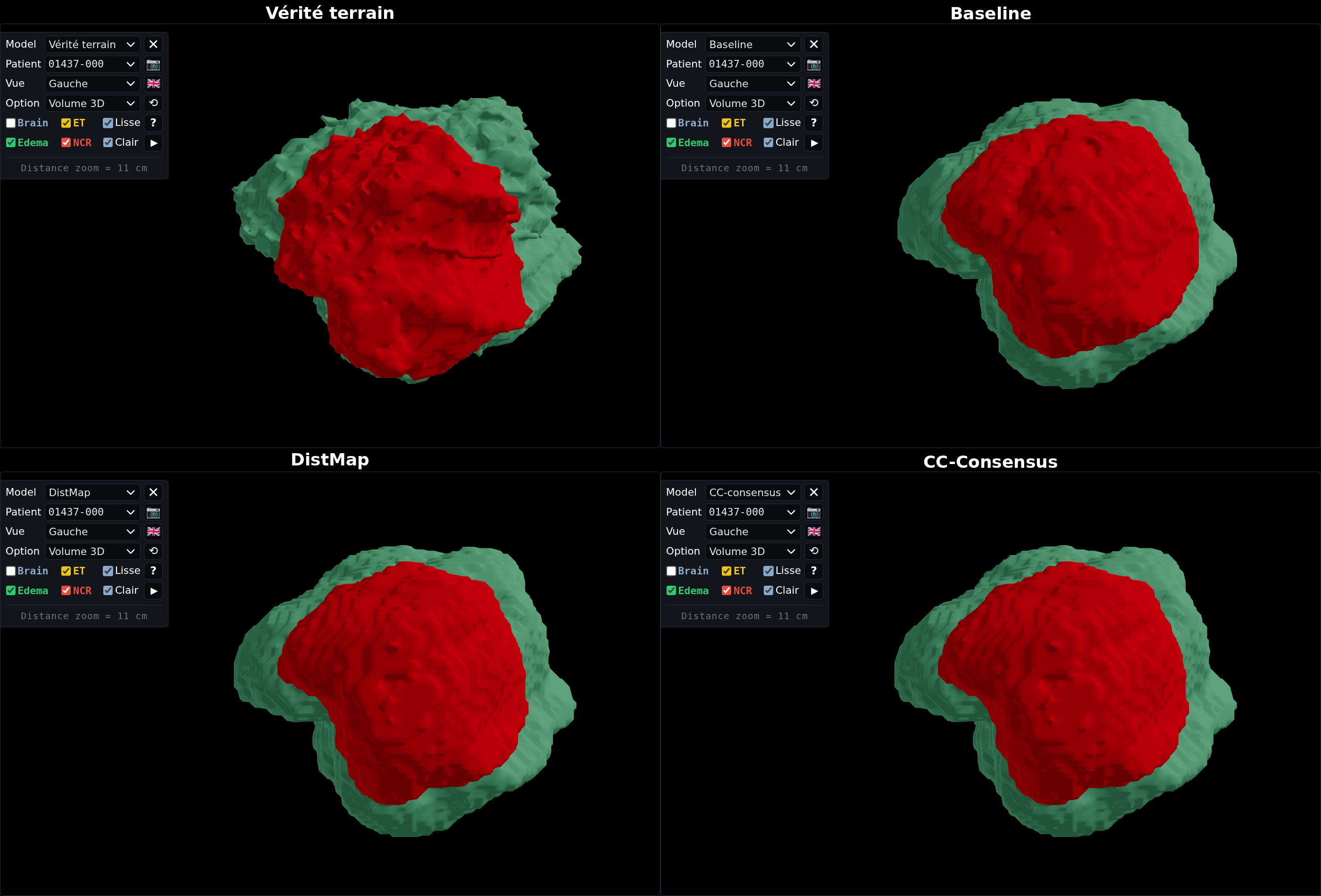 Figure 2 — Cas C2 (01437-000)
